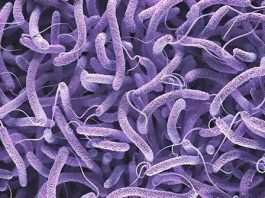 Cholera Outbreak Hits Plateau, Five Dead as 11 Cases Are Confirmed